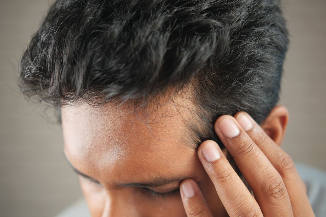 Hair Transplant Surgery treatment