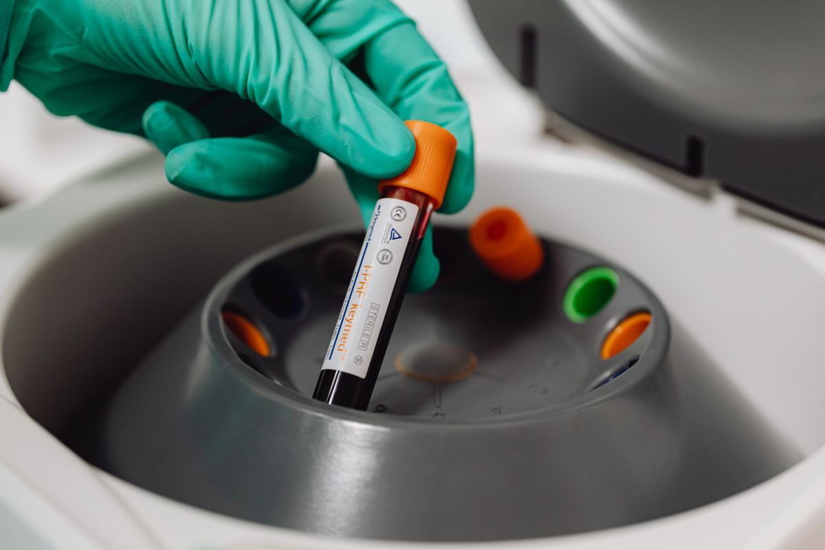 Regenerative Medicine Facelift (PRP) treatment